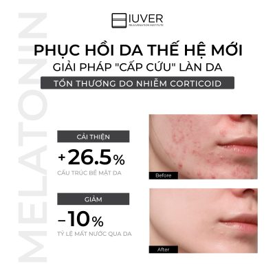 MELATONIN - HOẠT CHẤT PHỤC HỒI THẾ HỆ MỚI