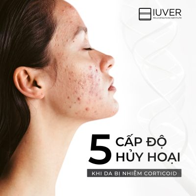 5 CẤP ĐỘ HỦY HOẠI LÀN DA KHI NHIỄM CORTICOID